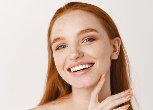 Photo of a woman with Skin Tone concerns