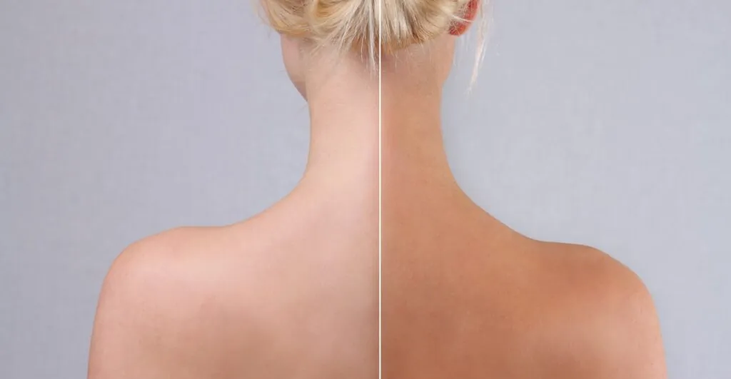 Before and after tanning results